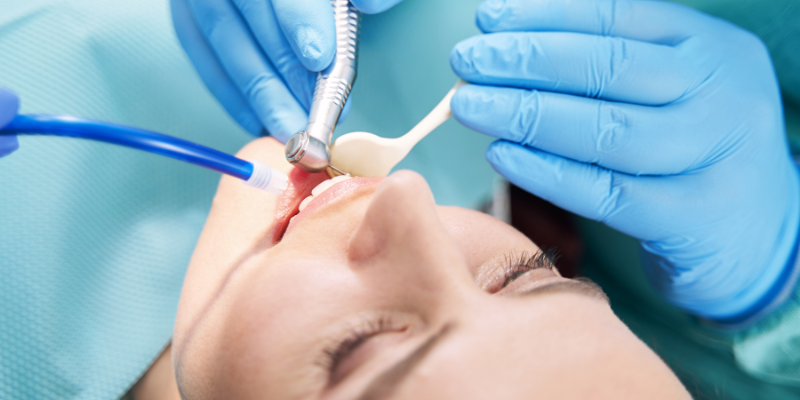 root canal therapy in Florence