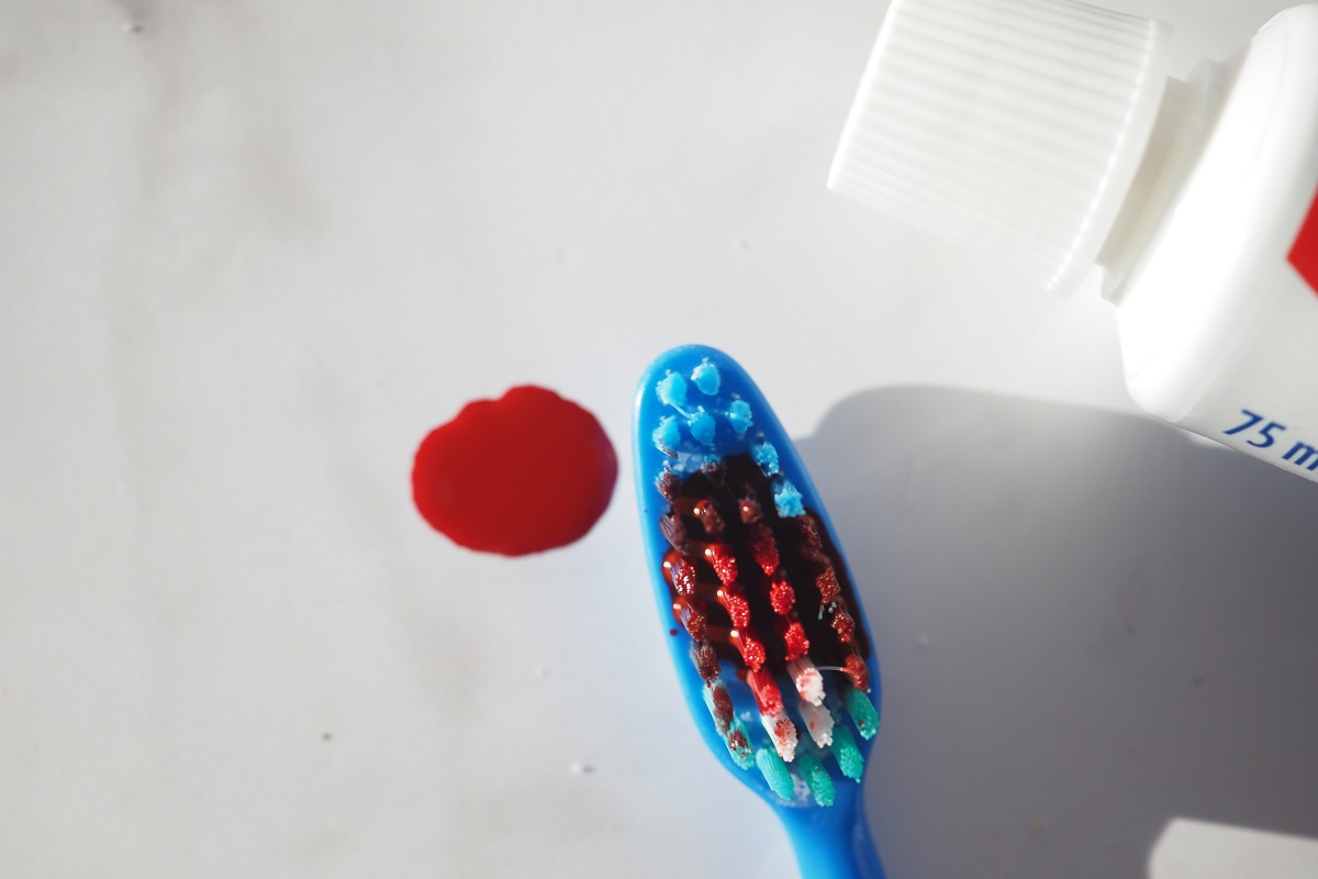 bleeding gums causes treatment by florence dentist