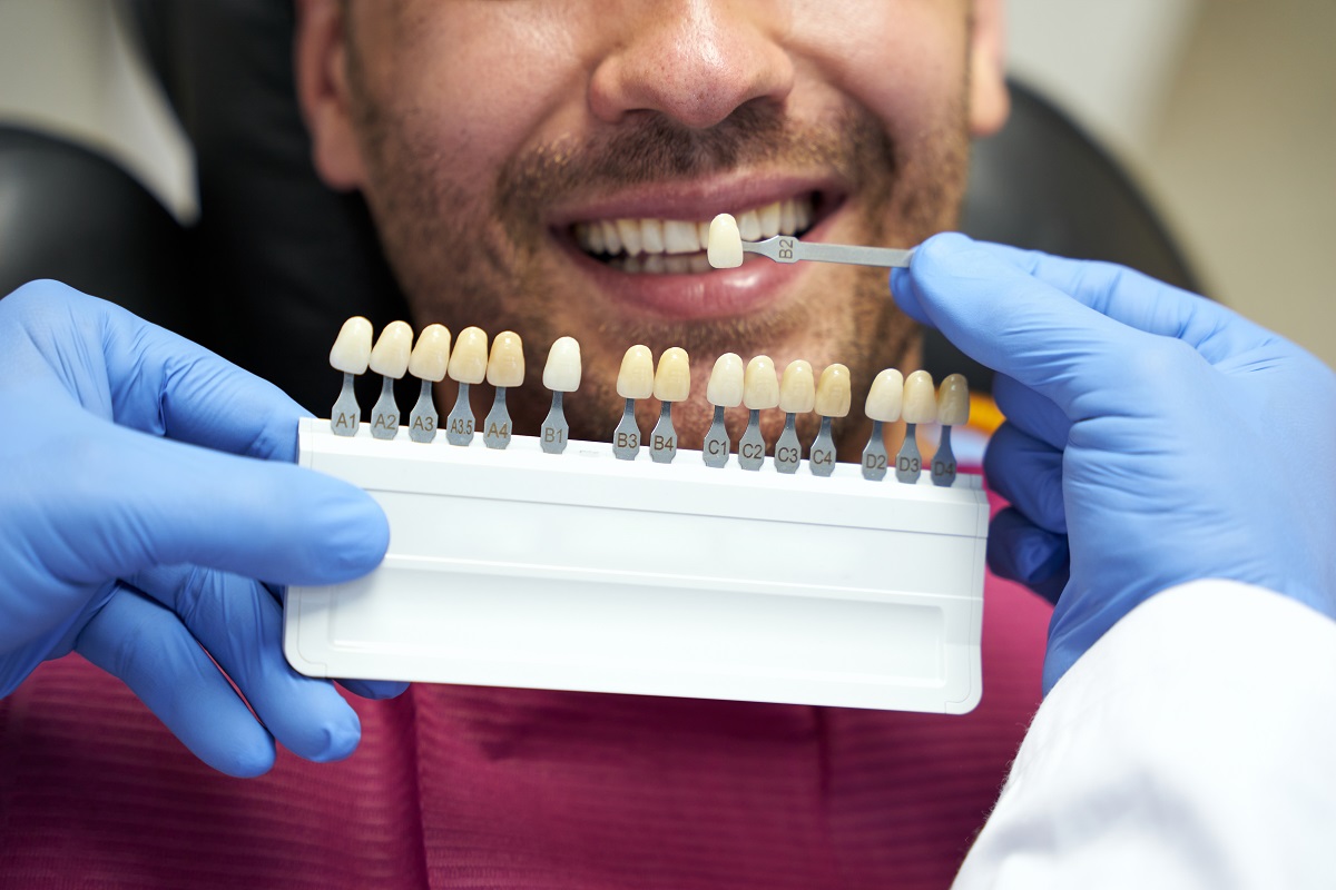 do veneers really ruin teeth veneers florence